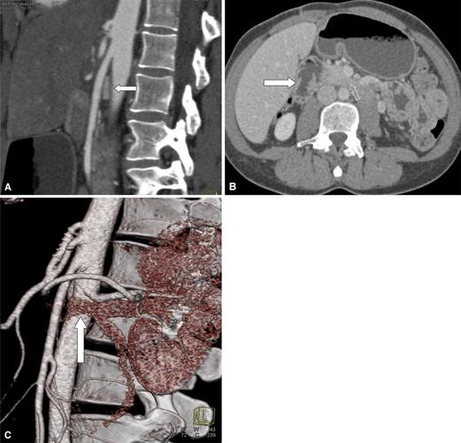 oms associates torrington ct,oms associates torrington ct: A Comprehensive Overview